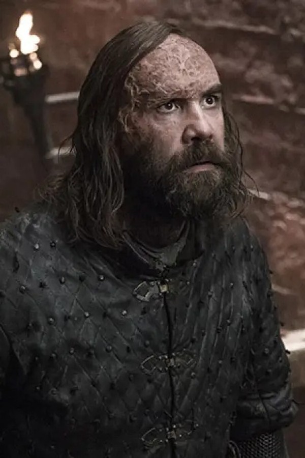 The Hound