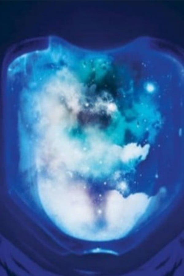 STARSET