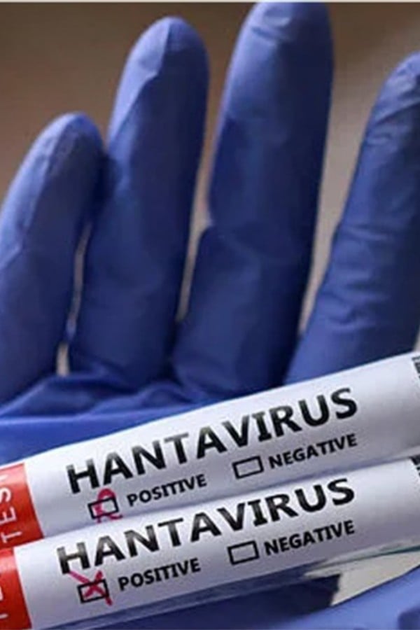 Viruses